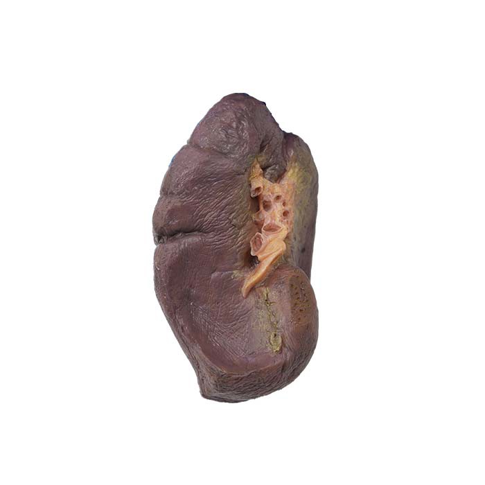 Модел на далака